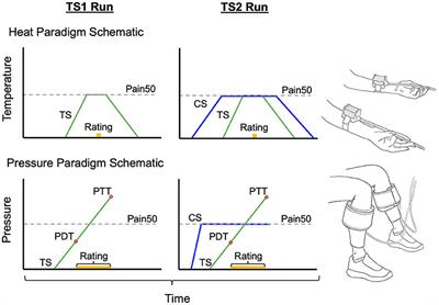 The Potential Clinical Utility of Pressure-Based vs. Heat-Based Paradigms to Measure Conditioned Pain Modulation in Healthy Individuals and Those With Chronic Pain